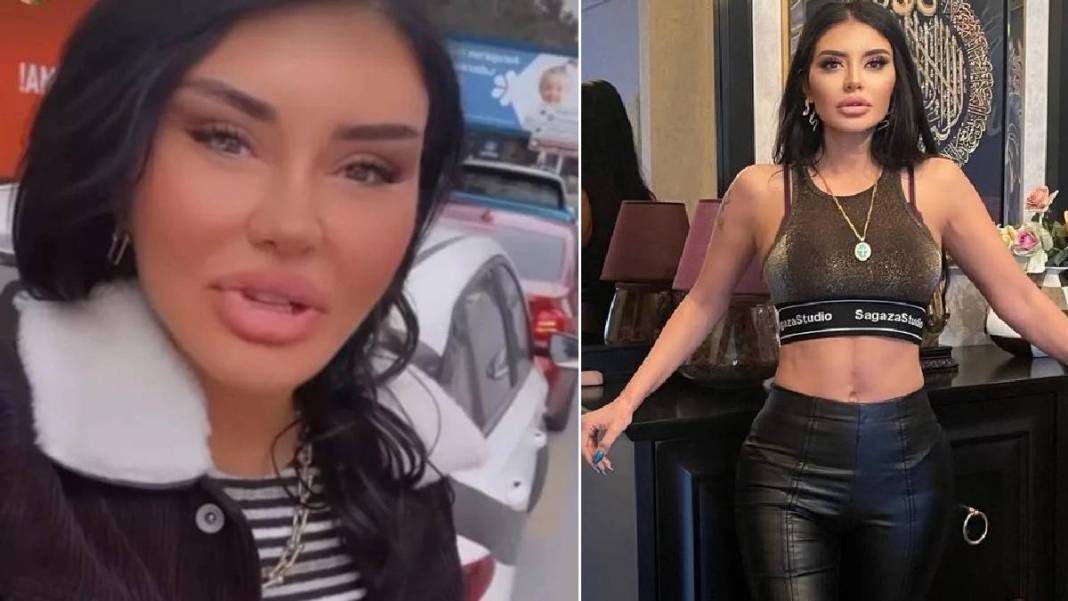 Ebru Polat son haliyle ağızları açık bıraktı! Yaptırdığı estetikle madara oldu: Abla eski halin daha güzeldi! 4